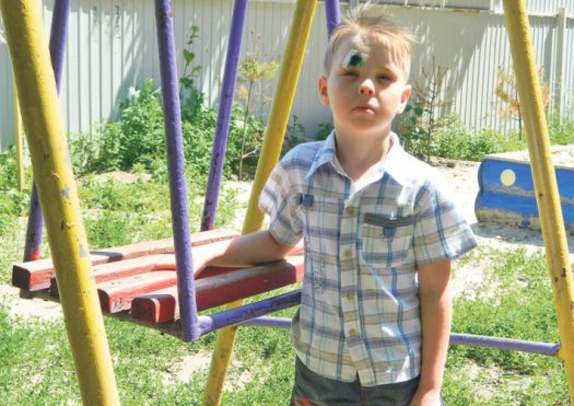 Недопустимо высокое сиденье качелей  с острыми углами 
разбило Паше Вольных лоб. И он далеко не первый травмированный во дворе дома № 50 по улице Чумичова