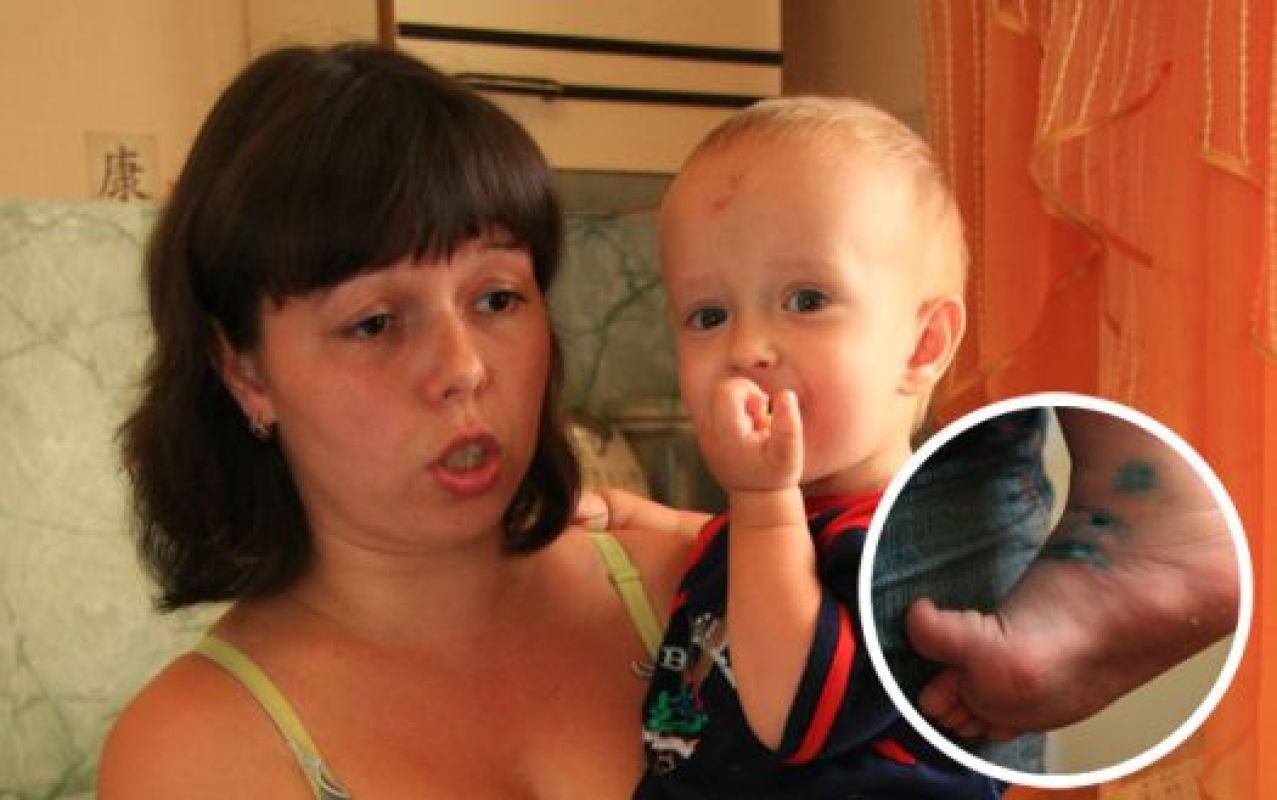 Молодая мама и не думала о том, что загородный отдых у свекрови может обернуться физическими и душевными ранами для её малыша