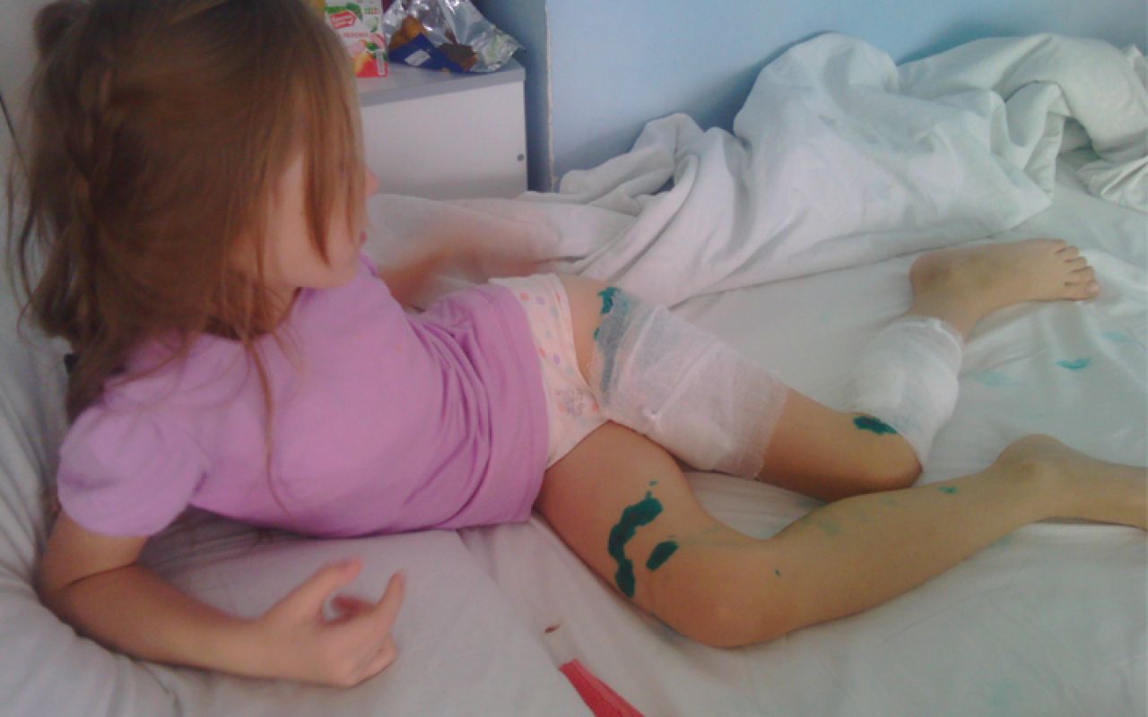 В Белгороде на двух 6-летних девочек напала бойцовская собака
